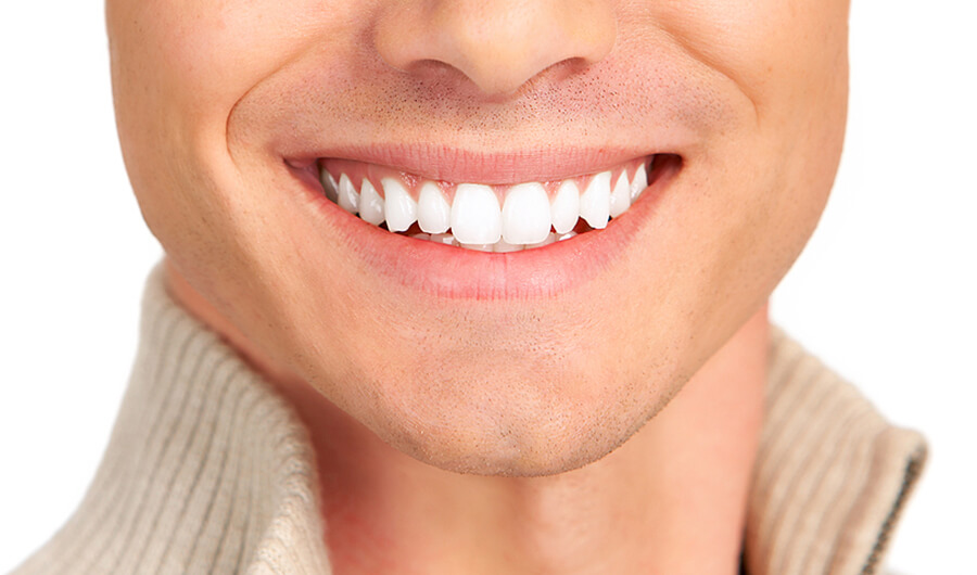 dental Bridges in nw calgary